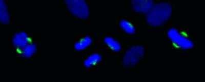 Immunocytochemistry/ Immunofluorescence: ASPM Antibody [NB100-2278]