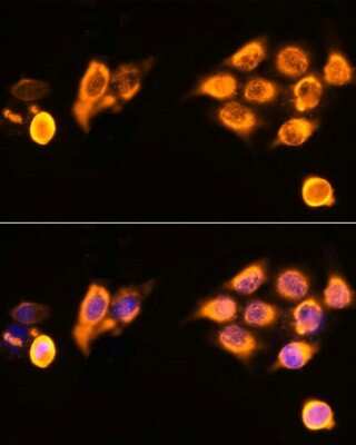 Immunocytochemistry/ Immunofluorescence: ASPM Antibody - Azide and BSA Free [NBP2-92395]