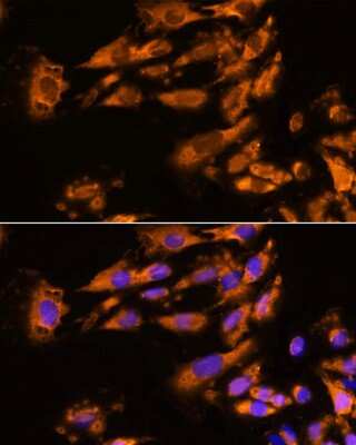 Immunocytochemistry/ Immunofluorescence: ASPM Antibody - Azide and BSA Free [NBP2-92395]