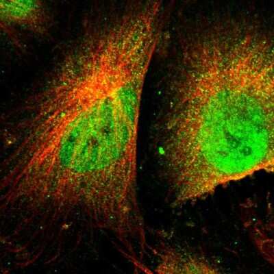 Immunocytochemistry/ Immunofluorescence: ASPP1 Antibody [NBP1-90078]
