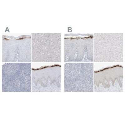 Immunohistochemistry-Paraffin: ASPRV1 Antibody [NBP1-83570]