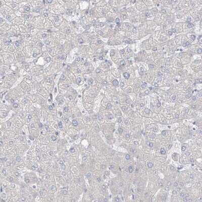 Immunohistochemistry-Paraffin: ASPRV1 Antibody [NBP1-83570]