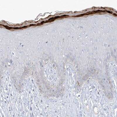 Immunohistochemistry-Paraffin: ASPRV1 Antibody [NBP1-83570]