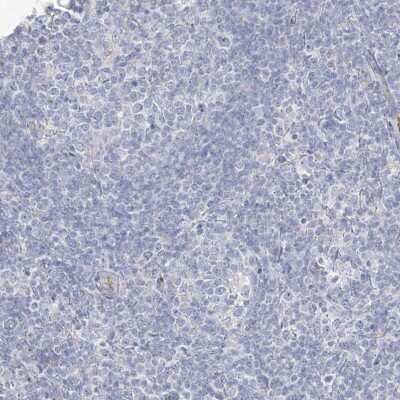 Immunohistochemistry-Paraffin: ASPRV1 Antibody [NBP1-83570]