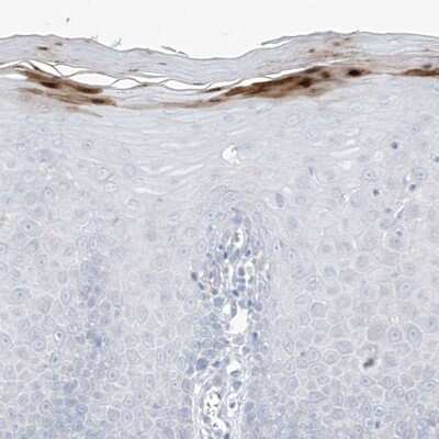 Immunohistochemistry-Paraffin: ASPRV1 Antibody [NBP1-83570]