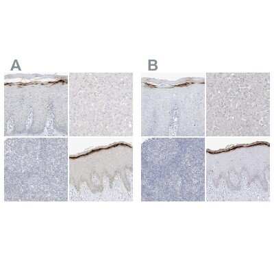Immunohistochemistry-Paraffin: ASPRV1 Antibody [NBP2-33981]