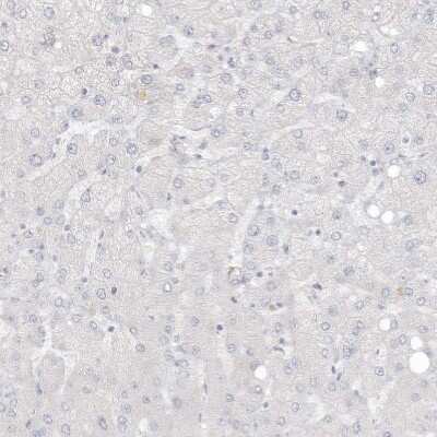 Immunohistochemistry-Paraffin: ASPRV1 Antibody [NBP2-33981]