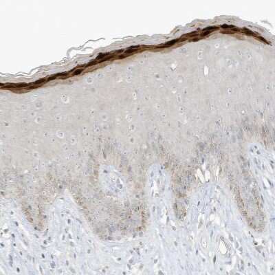 Immunohistochemistry-Paraffin: ASPRV1 Antibody [NBP2-33981]
