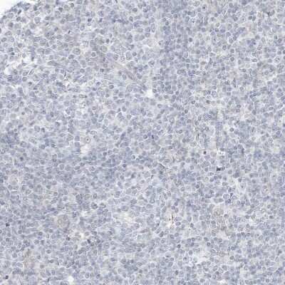 Immunohistochemistry-Paraffin: ASPRV1 Antibody [NBP2-33981]