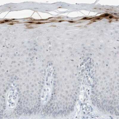 Immunohistochemistry-Paraffin: ASPRV1 Antibody [NBP2-33981]