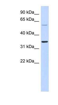 Western Blot: ASPRV1 Antibody [NBP1-56511]