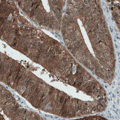 Immunohistochemistry: ASRGL1 Antibody (CL1679) [NBP2-42378]