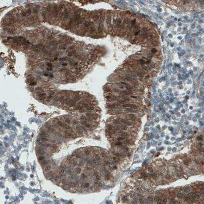 Immunohistochemistry: ASRGL1 Antibody (CL1679) [NBP2-42378]