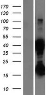 Western Blot: ASRGL1 Overexpression Lysate [NBP2-06243]