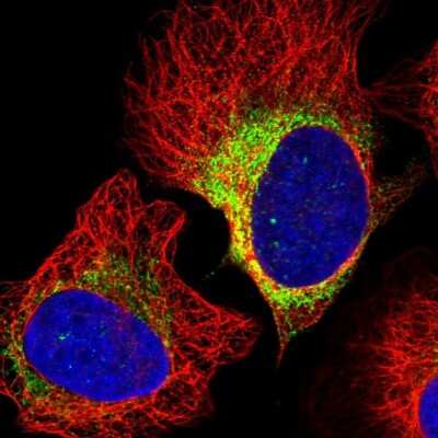 Immunocytochemistry/ Immunofluorescence: ASTE1 Antibody [NBP1-81661]