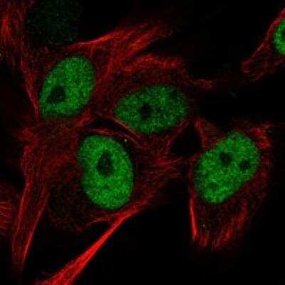 Immunocytochemistry/ Immunofluorescence: ASUN Antibody [NBP3-17344]