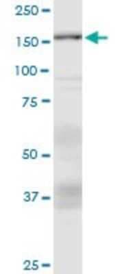 Western Blot: ASXL1 Antibody (6E2) [H00171023-M05]