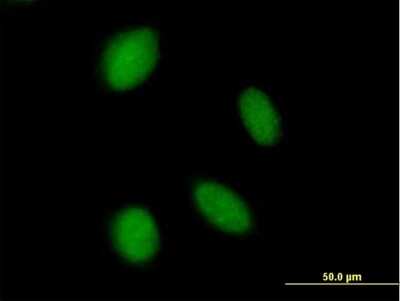 Immunocytochemistry/ Immunofluorescence: ASXL2 Antibody [H00055252-B01P]
