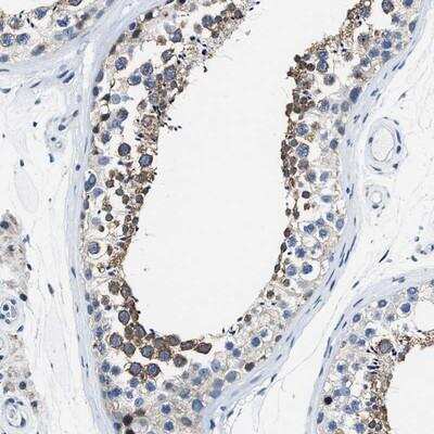 Immunohistochemistry-Paraffin: ASZ1 Antibody [NBP1-89130]