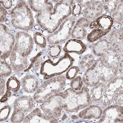 Immunohistochemistry-Paraffin: ATAD1 Antibody [NBP1-82228]