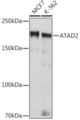 Western Blot: ATAD2 Antibody (2K7T2) [NBP3-15918]