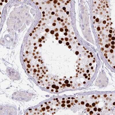 Immunohistochemistry-Paraffin: ATAD2 Antibody (CL0182) [NBP2-14786]