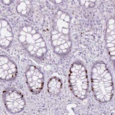 Immunohistochemistry-Paraffin: ATAD2 Antibody (CL0182) [NBP2-14786]