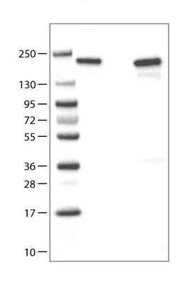 Western Blot: ATAD2 Antibody (CL0182) [NBP2-14786]