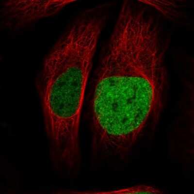 Immunocytochemistry/ Immunofluorescence: ATAD2 Antibody [NBP1-84123]