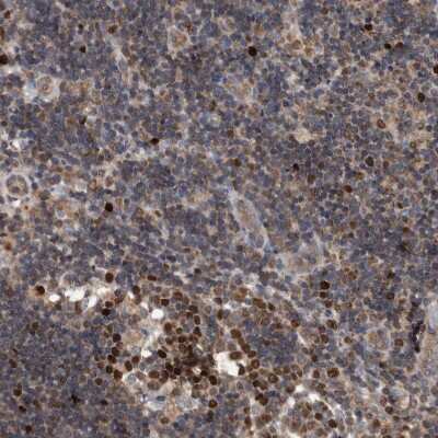 Immunohistochemistry-Paraffin: ATAD2 Antibody [NBP1-84123]