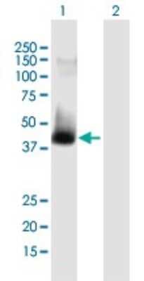 Western Blot: ATAD2 Antibody [H00029028-B01P]