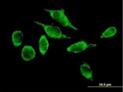 Immunocytochemistry/ Immunofluorescence: ATAD3A Antibody [H00055210-B01P]