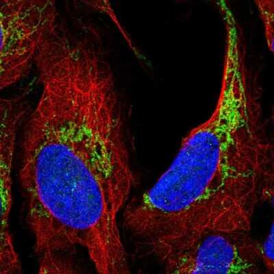 Immunocytochemistry/ Immunofluorescence: ATAD3A Antibody [NBP2-57335]