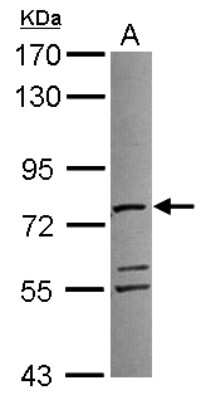 Western Blot: ATAD3A Antibody [NBP2-14881]