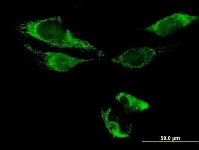 Immunocytochemistry/ Immunofluorescence: ATAD3B Antibody [H00083858-B01P]