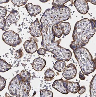 Immunohistochemistry-Paraffin: ATAD3B Antibody [NBP2-32409]