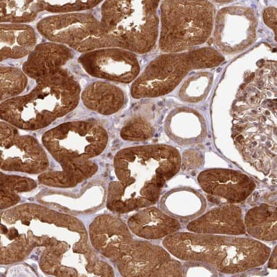Immunohistochemistry-Paraffin: ATAT1 Antibody [NBP2-48860]