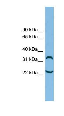 Western Blot: ATAT1 Antibody [NBP1-57667]