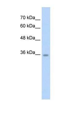 Western Blot: ATAT1 Antibody [NBP1-57690]