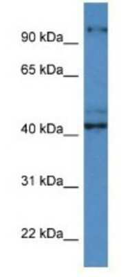 Western Blot: ATCAY Antibody [NBP1-74085]