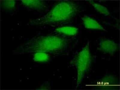 Immunocytochemistry/ Immunofluorescence: ATE1 Antibody (2B6) [H00011101-M01]