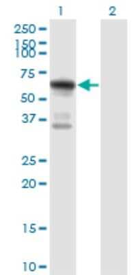 Western Blot: ATE1 Antibody (2B6) [H00011101-M01]