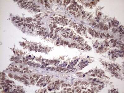 Immunohistochemistry: ATF1 Antibody (OTI2B4) [NBP2-46552]