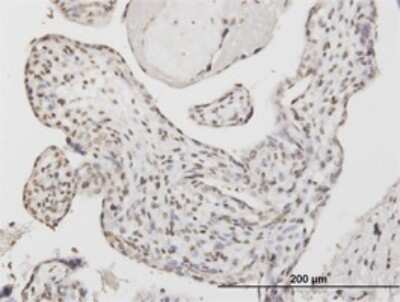 Immunohistochemistry-Paraffin: ATF1 Antibody (3E7) [H00000466-M03]