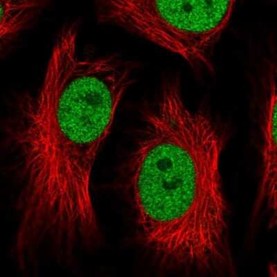 Immunocytochemistry/ Immunofluorescence: ATF1 Antibody [NBP2-38747]
