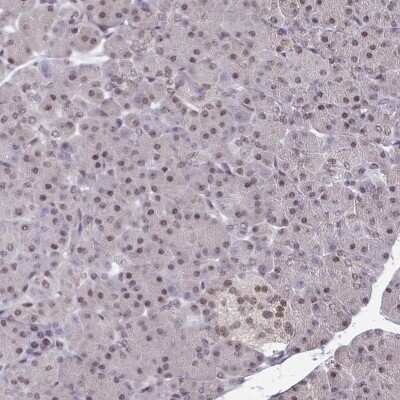 Immunohistochemistry-Paraffin: ATF1 Antibody [NBP2-38747]