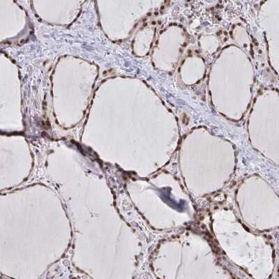 Immunohistochemistry-Paraffin: ATF1 Antibody [NBP2-38747]