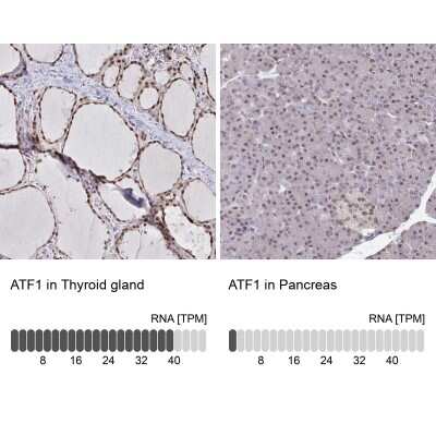 Immunohistochemistry-Paraffin: ATF1 Antibody [NBP2-38747]