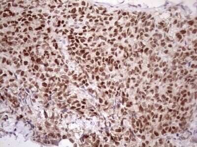 Immunohistochemistry: ATF1 Antibody (OTI2B4) - Azide and BSA Free [NBP2-70218]