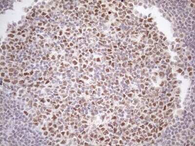 Immunohistochemistry: ATF1 Antibody (OTI2B4) - Azide and BSA Free [NBP2-70218]